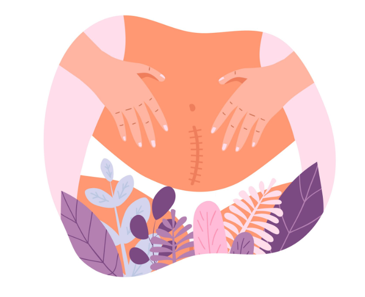 drainage-lymphatique